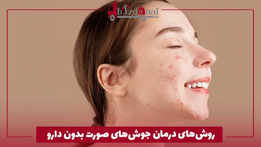 روش‌های درمان جوش‌های صورت بدون دارو