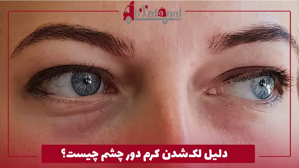 دلیل لک‌شدن کرم دور چشم چیست؟ 