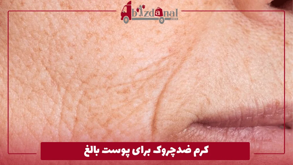 کرم ضدچروک برای پوست بالغ